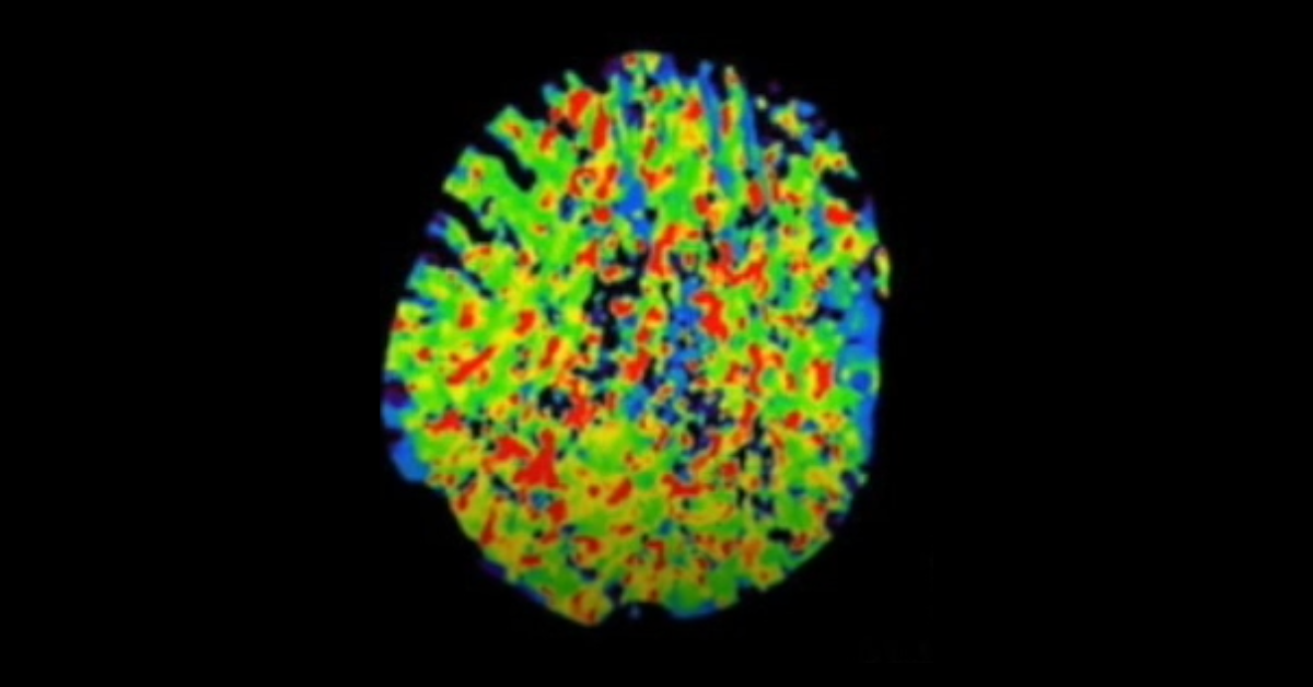 Perfusion Imaging Part 3