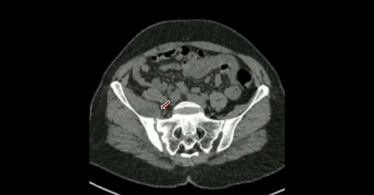 Musculoskeletal Imaging: Recognizing Key Radiographic Findings
