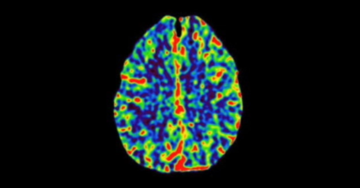 Perfusion Imaging Part 2
