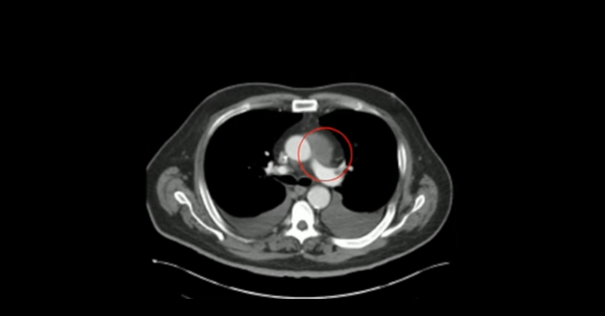 Emergency Cardiac CT: Part 1