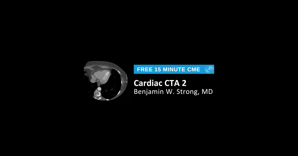 Cardiac CTA 2