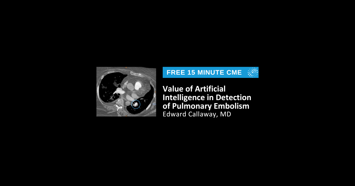 Value of Artificial Intelligence in Detection of Pulmonary Embolism