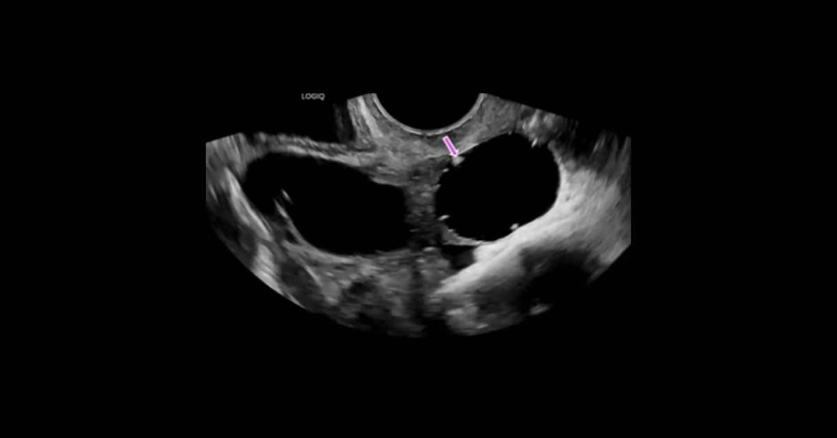 Ultrasound of the Abdomen and Pelvis