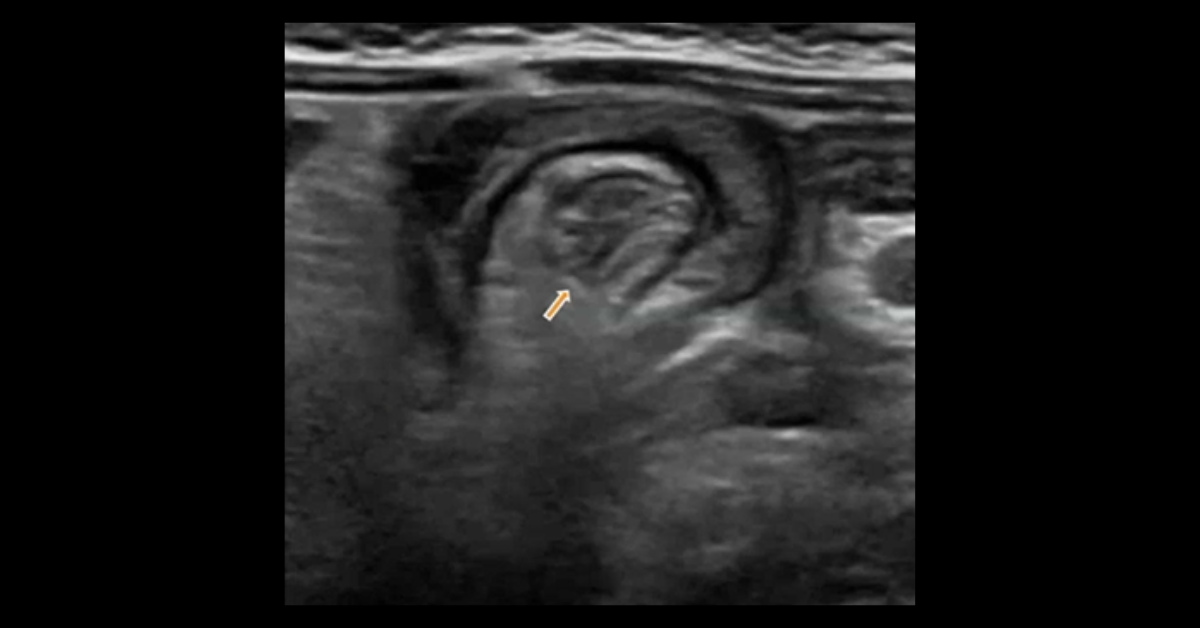 Ultrasound of the Abdomen, Pelvis, & Extremity