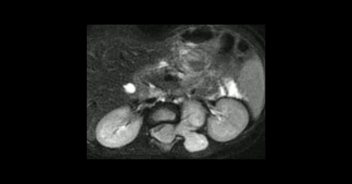 Pediatric Soft Tissue Abnormalities