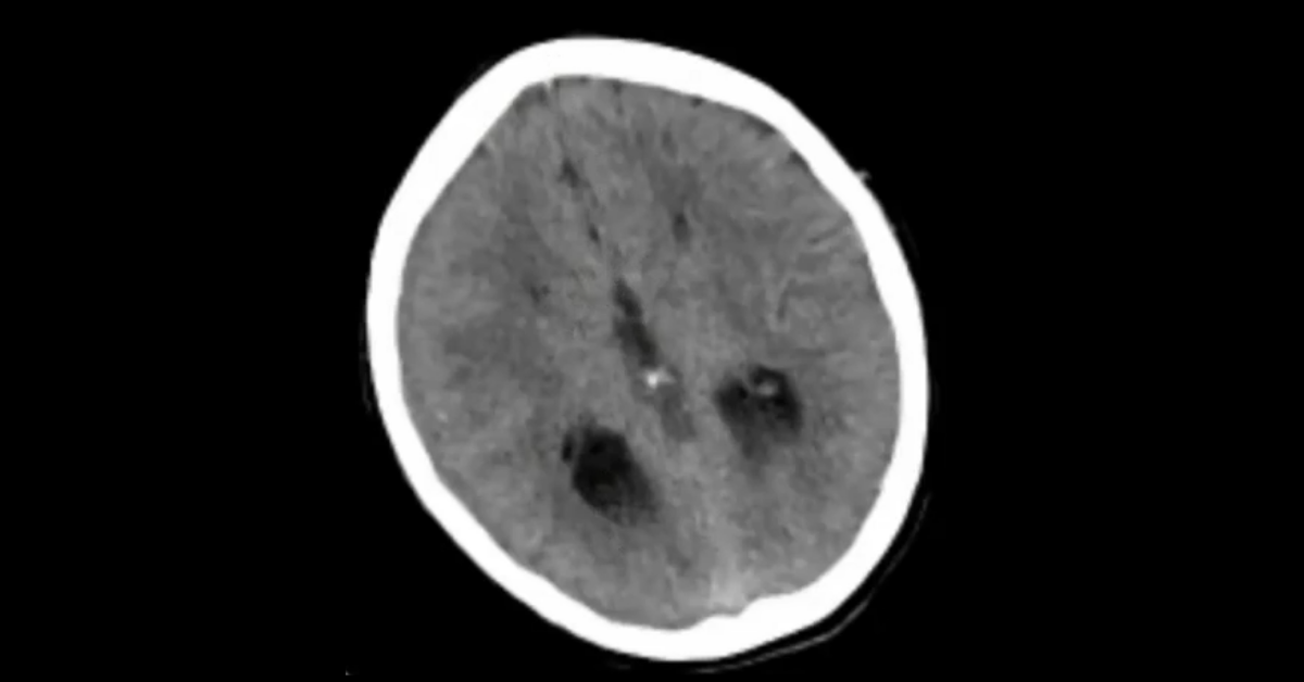 Pediatric CT Imaging