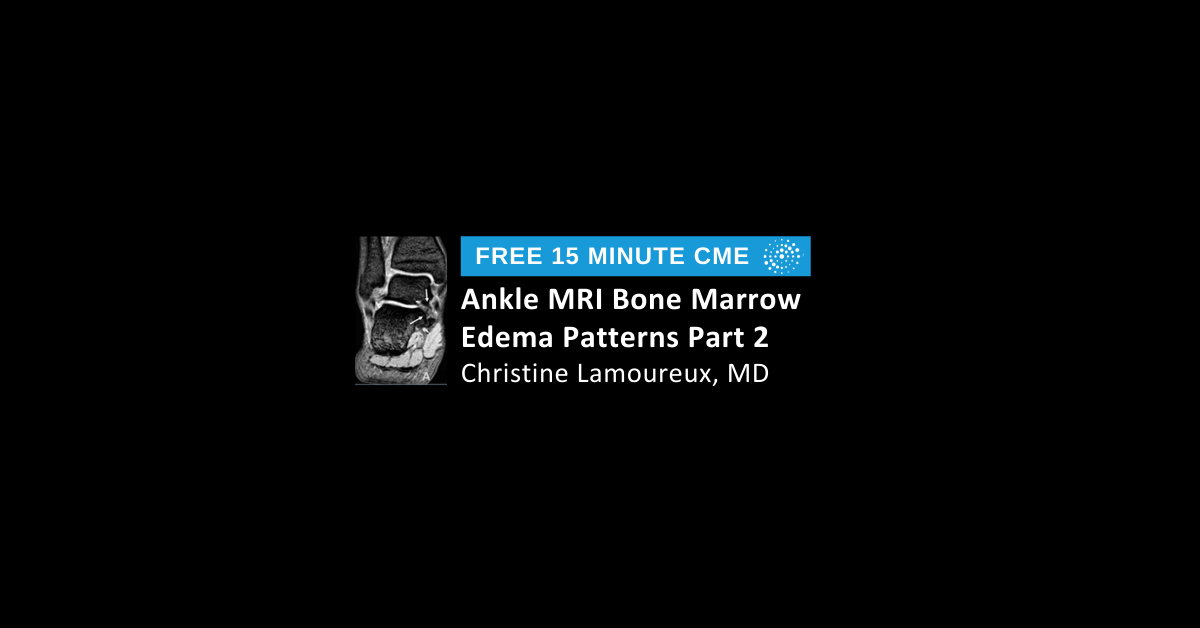 Ankle MRI Bone Marrow Edema Patterns Part 2: Non-Traumatic Causes