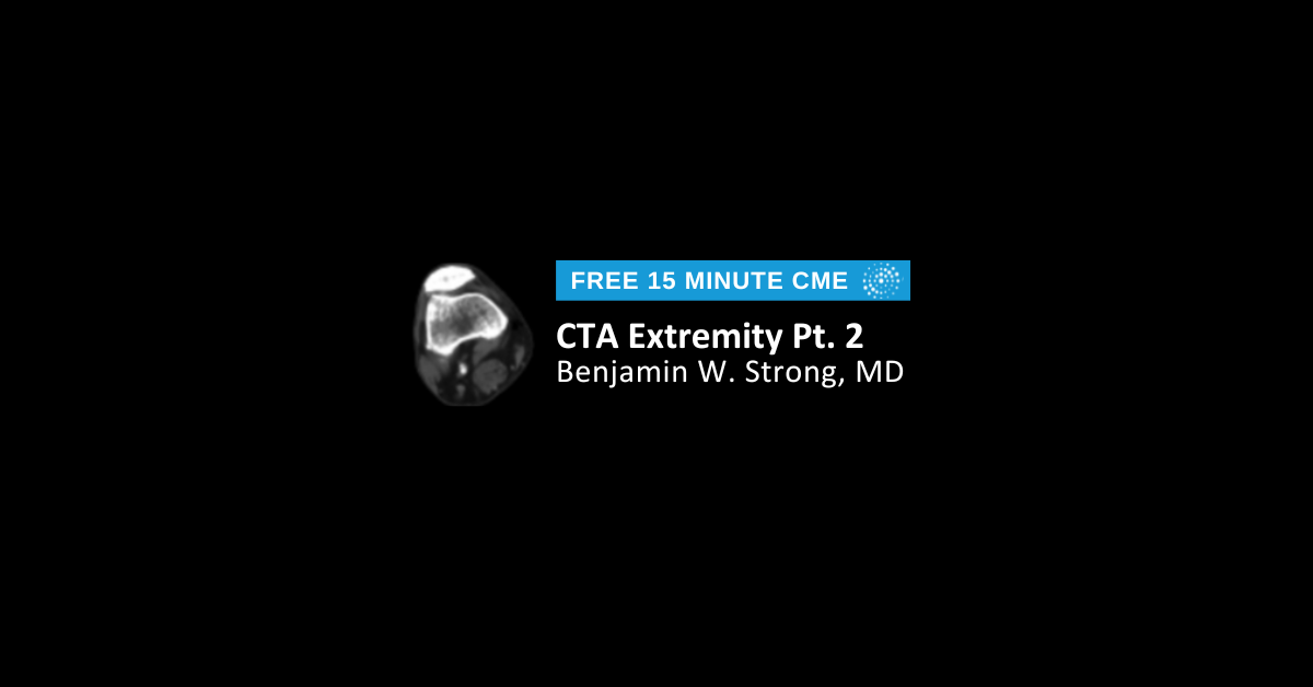 CTA Extremity Pt. 2